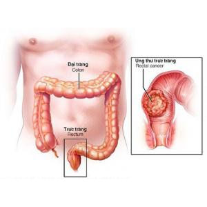 2. Tác dụng chữa bệnh liên quan đến tuyến tính, trực tràng